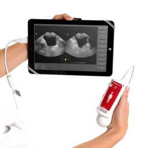 VitaScan v.2 Bladder Scanner Transducer (without Tablet)